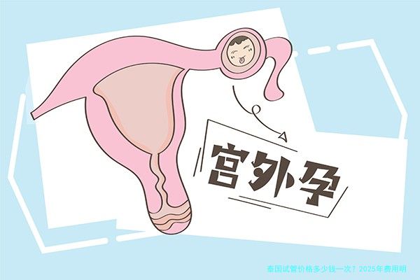 泰国试管价格多少钱一次?2025年费用明细与影响因素