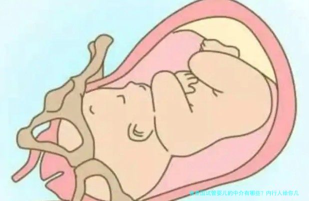 做泰国试管婴儿的中介有哪些?内行人给你几个实在提醒